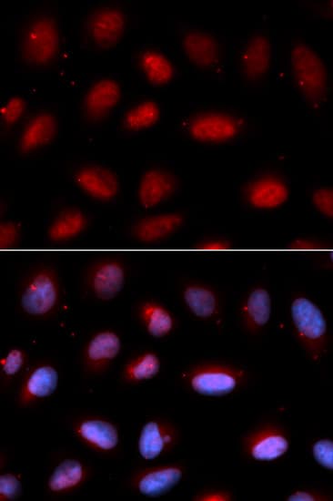 IHC-plus™ SERPINA6 / CBG Antibody
