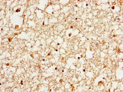 YWHAE / 14-3-3 Epsilon Antibody