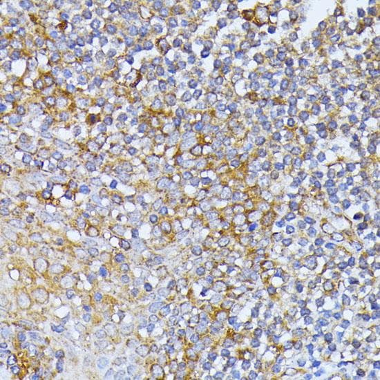 Polyclonal Rabbit anti-Human EIF2B2 Antibody (IHC, IF)