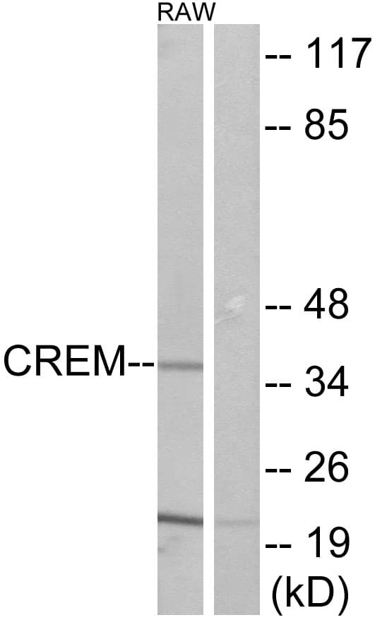 Polyclonal Rabbit anti-Human CREM / ICER Antibody (aa81-130, WB)