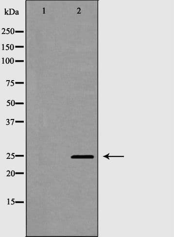 Polyclonal Rabbit anti-Human CLEC4D / MCL Antibody (IHC, WB)