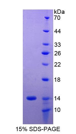 Human HLA-G Protein (Recombinant His)