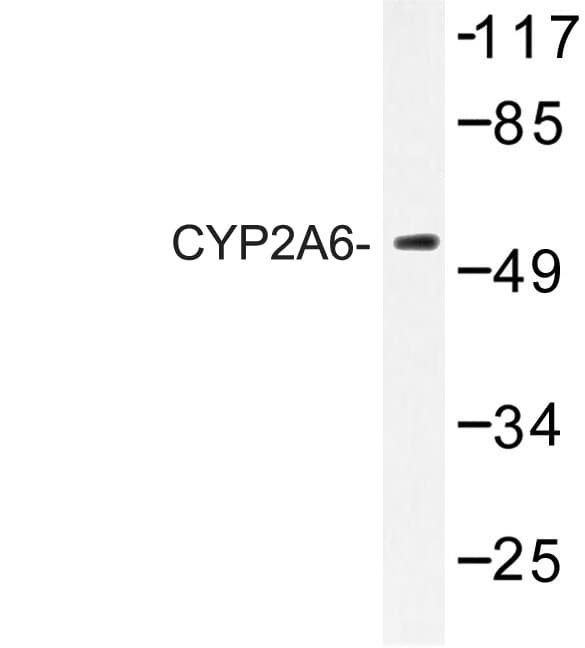 Polyclonal Rabbit anti-Human CYP2A6 Antibody (Glu131, IF, WB)
