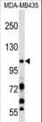 PIK3CB / PI3K Beta Antibody (aa124-154)
