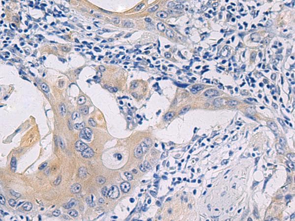 GALR3 / Galanin Receptor 3 Antibody
