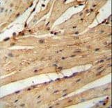 Polyclonal Rabbit anti-Human LARP6 / ACHN Antibody (aa7-35, IHC, WB)
