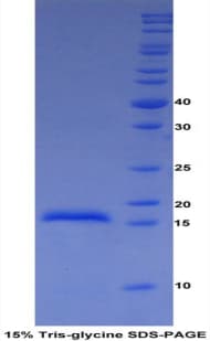 Bovine ADAMTS2 Protein (Recombinant His)