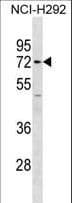 MMP14 Antibody (aa495-523)