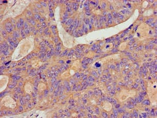 Polyclonal Rabbit anti-Human BCAR1 / p130Cas Antibody (IHC, IF, WB)