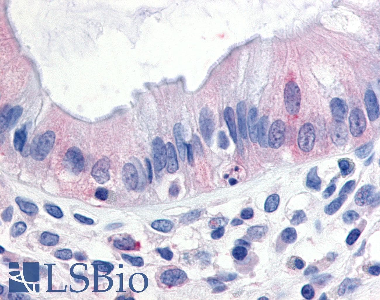 IHC-plus™ Polyclonal Rabbit anti-Human MAP3K8 / TPL2 Antibody (N-Terminus, IHC)
