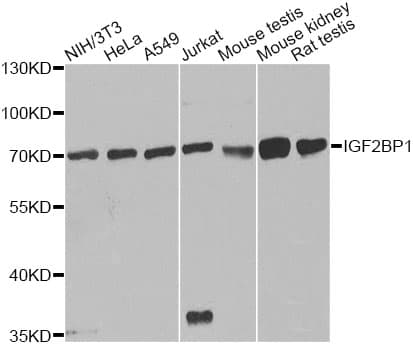 Polyclonal Rabbit anti-Human CRD-BP / ZBP1 / IGF2BP1 Antibody (IHC, IF, WB)
