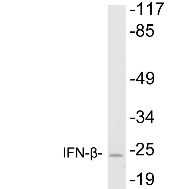Polyclonal Rabbit anti-Human IFN Beta / Interferon Beta Antibody (aa87-136, WB)