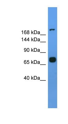 MYH7 Antibody (aa1251-1300)