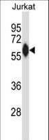 Polyclonal Rabbit anti-Human ZAP70 Antibody (aa103-130, IHC, WB)
