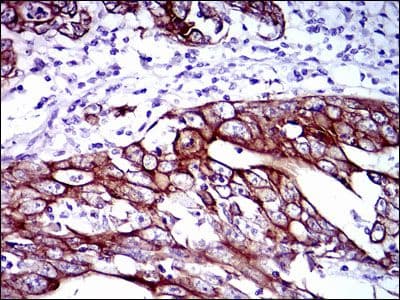 KRT5 / CK5 / Cytokeratin 5 Antibody (clone 2C2)
