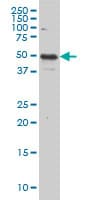 IL13RA2 / IL13R Alpha 2 Antibody (clone 2E10)