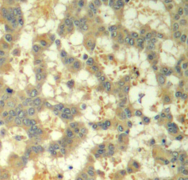SYK Antibody (phospho-Tyr323)