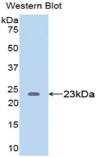 VWF / Von Willebrand Factor Antibody (aa49-230)