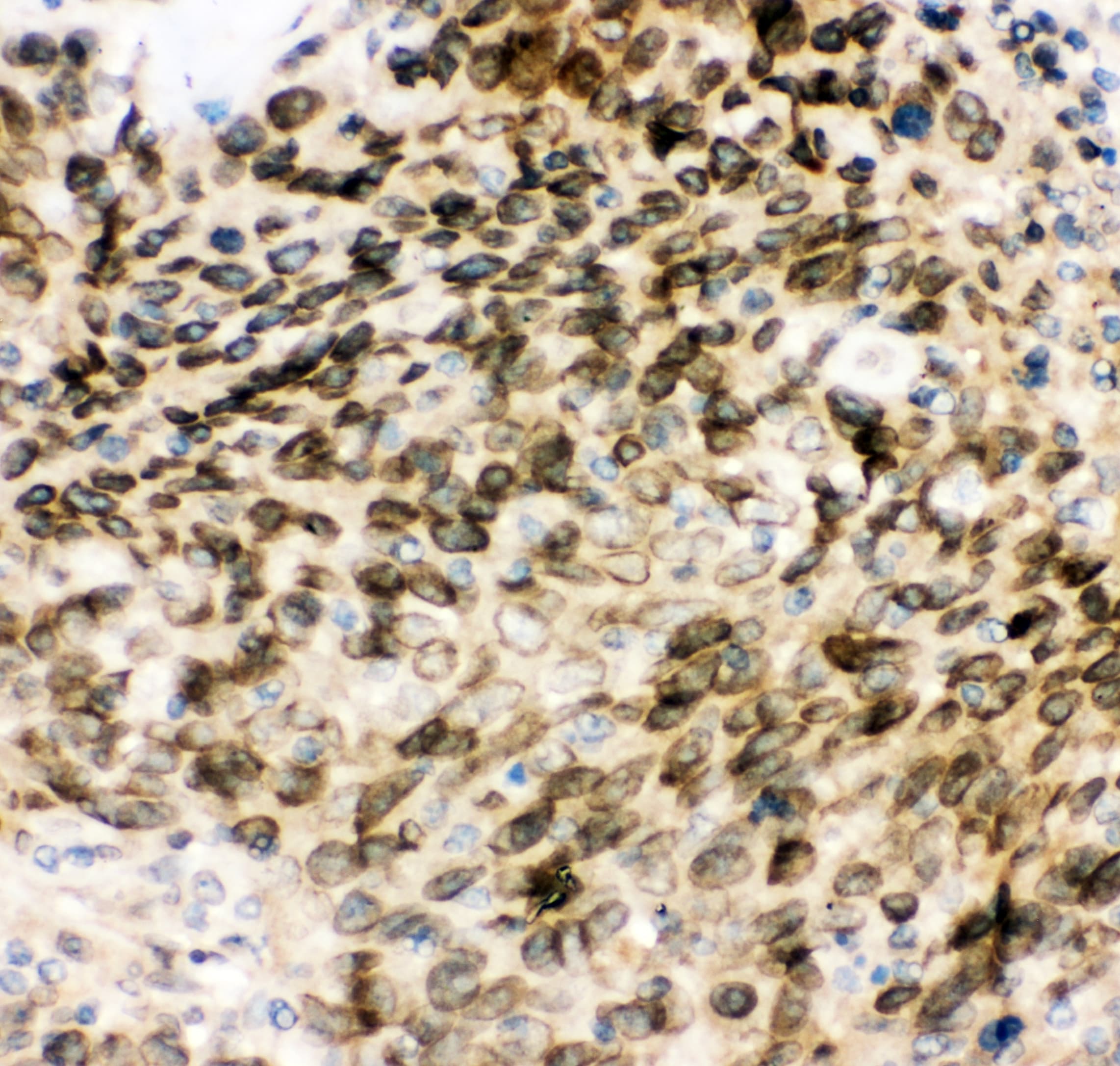 MAD1L1 / MAD1 Antibody (aa362-632)