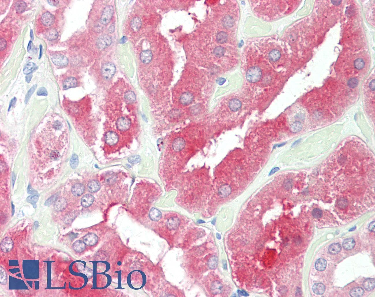 PathPlus™ Polyclonal Goat anti-Human HDAC6 Antibody (aa1100-C-term, IHC, WB)