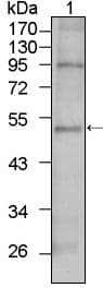 Monoclonal Mouse anti-Human TBX5 Antibody (clone 7B11, WB)