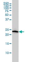 VBP1 Antibody (clone 3D11)
