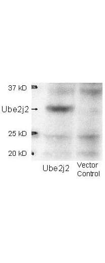 UBC6 / UBE2J2 Antibody