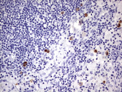 Monoclonal Mouse anti-Human CD34 Antibody (clone OTI39B1, IHC, WB)