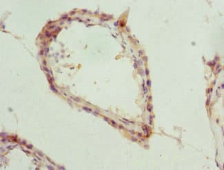 TPP2 Antibody