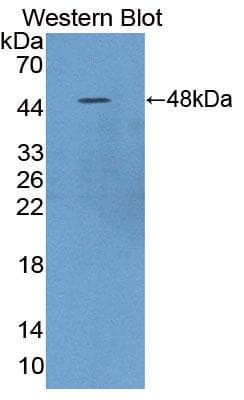 Polyclonal Rabbit anti-Human SERPINB4 / SCCA1+2 Antibody (aa2-390, WB)