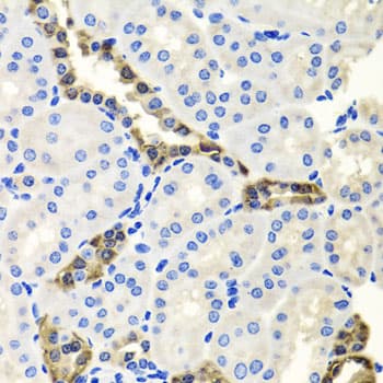 Endonuclease G / ENDOG Antibody