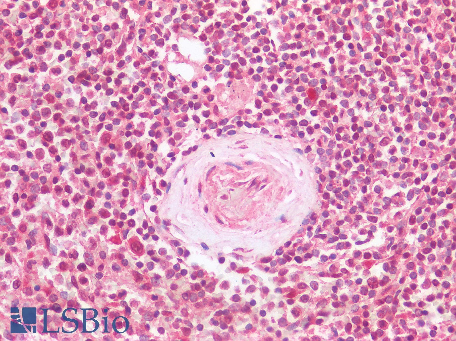 IHC-plus™ Polyclonal Rabbit anti-Human TIGIT Antibody (IHC)