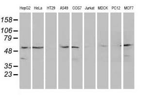 KATNAL1 Antibody (clone OTI4G1)