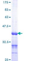 Human HRAS / H-Ras Protein (Recombinant GST, N-terminus)