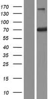RABEP2 Protein (Over-Expression Lysate Myc-DDK (Flag))