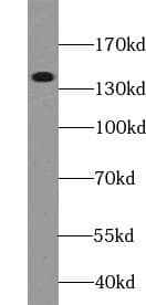 ABCB1 / MDR1 / P Glycoprotein Antibody