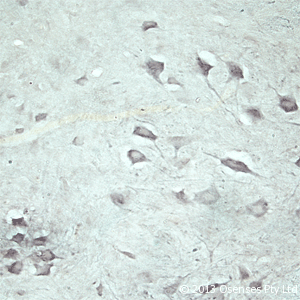 Polyclonal Rabbit anti-Rat VPS45 Antibody (Internal, IHC, WB)