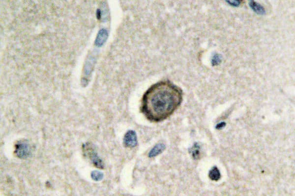 CDH8 / Cadherin 8 Antibody (Ala519)