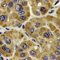 Carboxylesterase 1 / CES1 Antibody