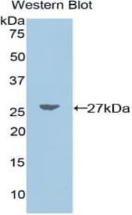 UCHL1 / PGP9.5 Antibody (aa2-223)