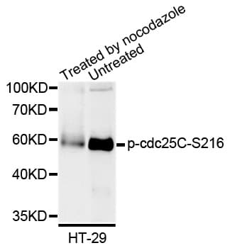 Polyclonal Rabbit anti-Human CDC25C Antibody (phospho-Ser216, WB)