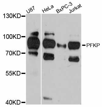 PFKP Antibody
