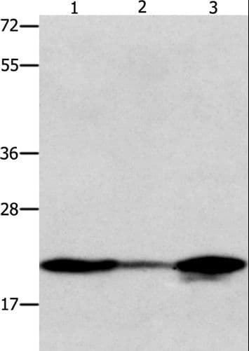 NME1 / NM23 Antibody