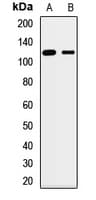 Polyclonal Rabbit anti-Human SLC12A7 / KCC4 Antibody (WB)