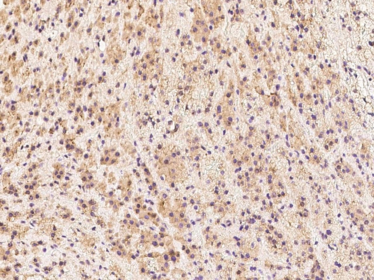 SEMA3A / Semaphorin 3A Antibody