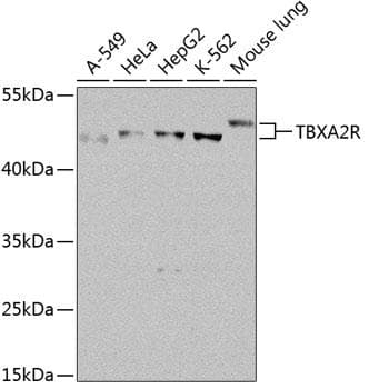 Polyclonal Rabbit anti-Human Thromboxane A2 Receptor Antibody (WB)