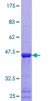 Human MMS2 / UBE2V2 Protein (Recombinant GST)