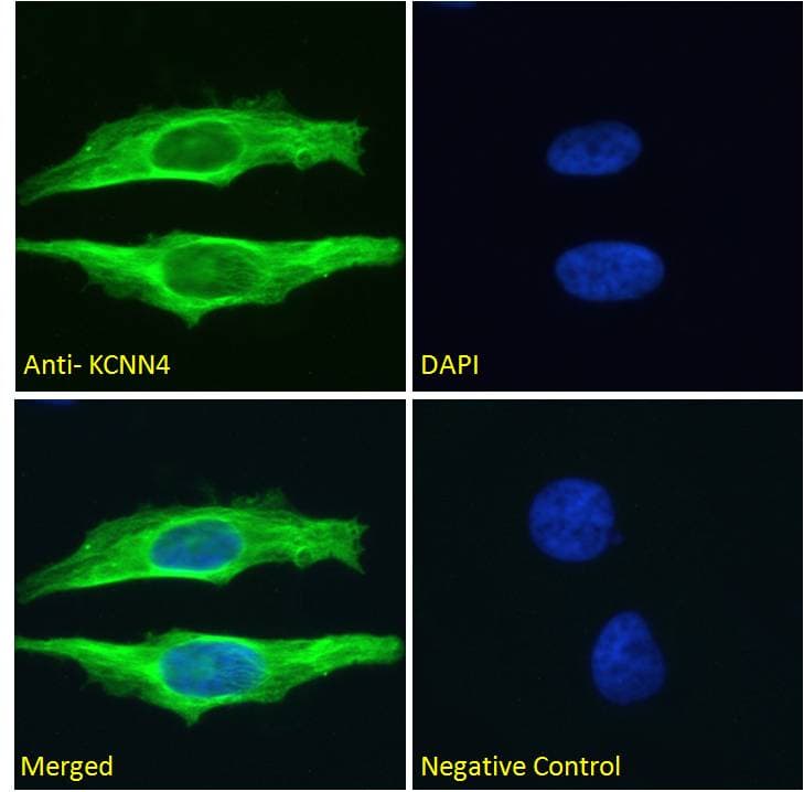IHC-plus™ Polyclonal Goat anti-Human KCNN4 / KCa3.1 Antibody (aa227-239, IHC, IF, WB)