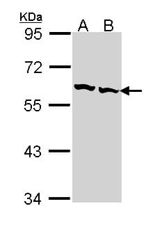 IHC-plus™ CCT2 / CCT Beta Antibody