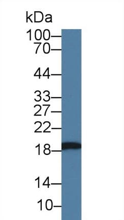 HSPB6 / HSP20 Antibody (aa1-162, PE)